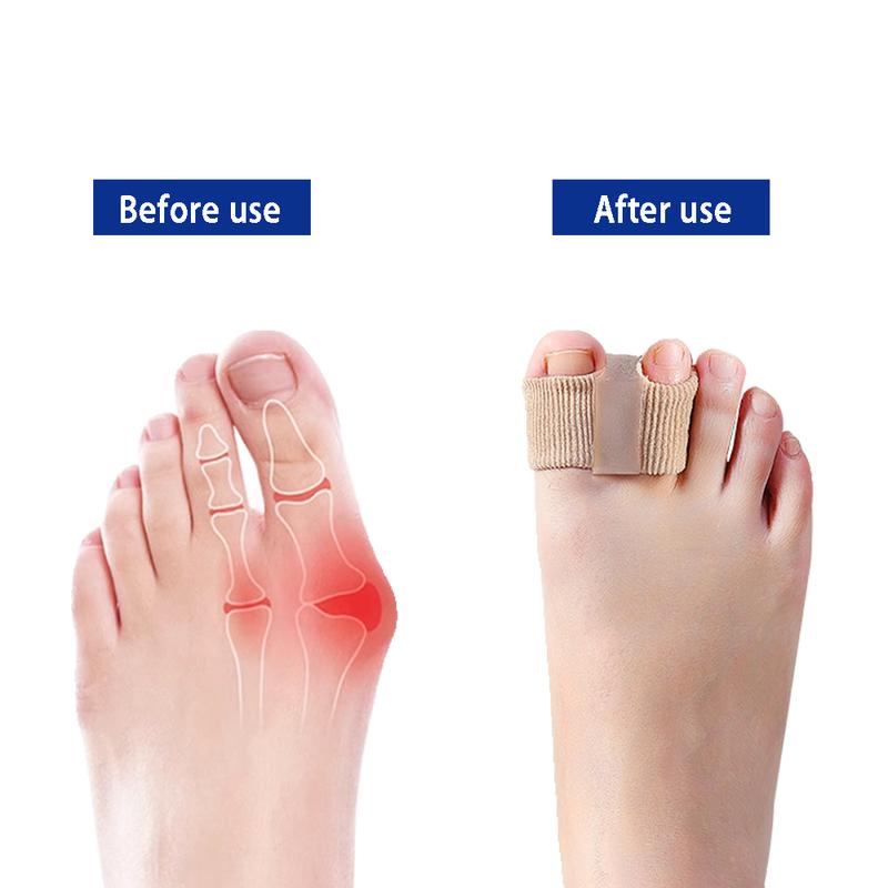 Premium Elastic Toe Separators – Comfortable Pain Relief & Alignment Zorenza