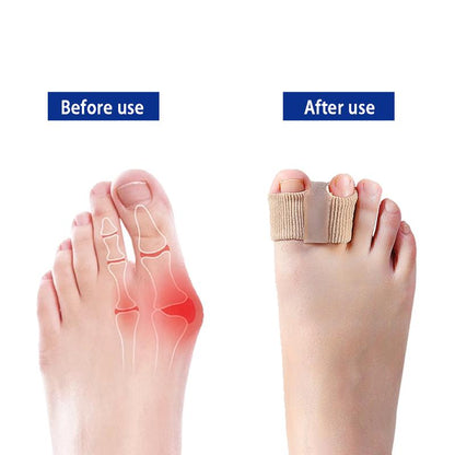 Premium Elastic Toe Separators – Comfortable Pain Relief & Alignment Zorenza
