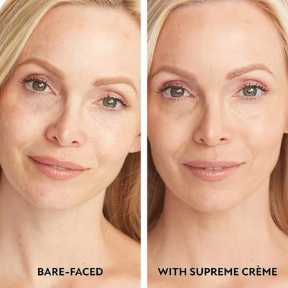 Supreme Crème – All-in-One Feuchtigkeitspflege & Abdeckcreme Zorenza