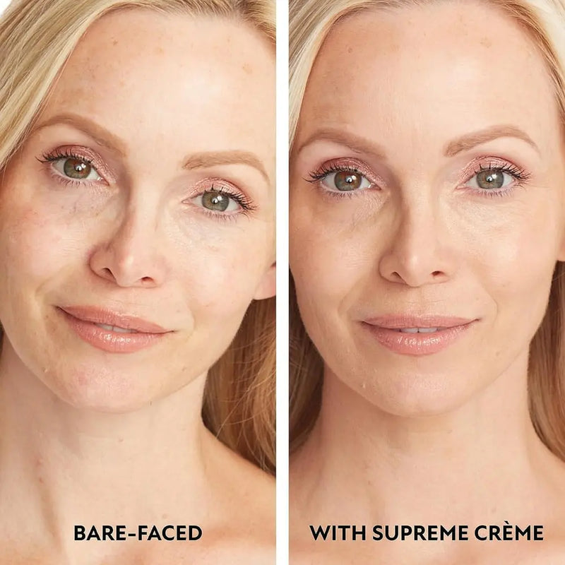 Supreme Crème – All-in-One Feuchtigkeitspflege & Abdeckcreme Zorenza