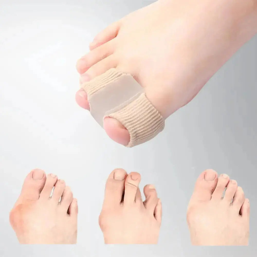 Zehenausrichter — Korrigiert Hallux & überlappende Zehen sanft Mivoza Deutschland