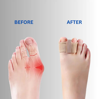 1 Paar + 2 Paren GRATIS VANDAAG | AlignToe™ Mivoza Deutschland